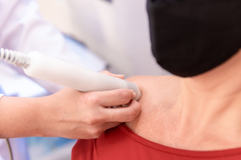 Foto 6 de Perfil Linear