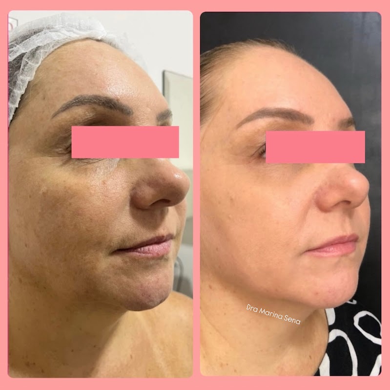 Casa Marina Sena Estética Avançada e Harmonização Facial - Clínica de Estética em Jardim Camburi, Vitória/ES - Foto 3