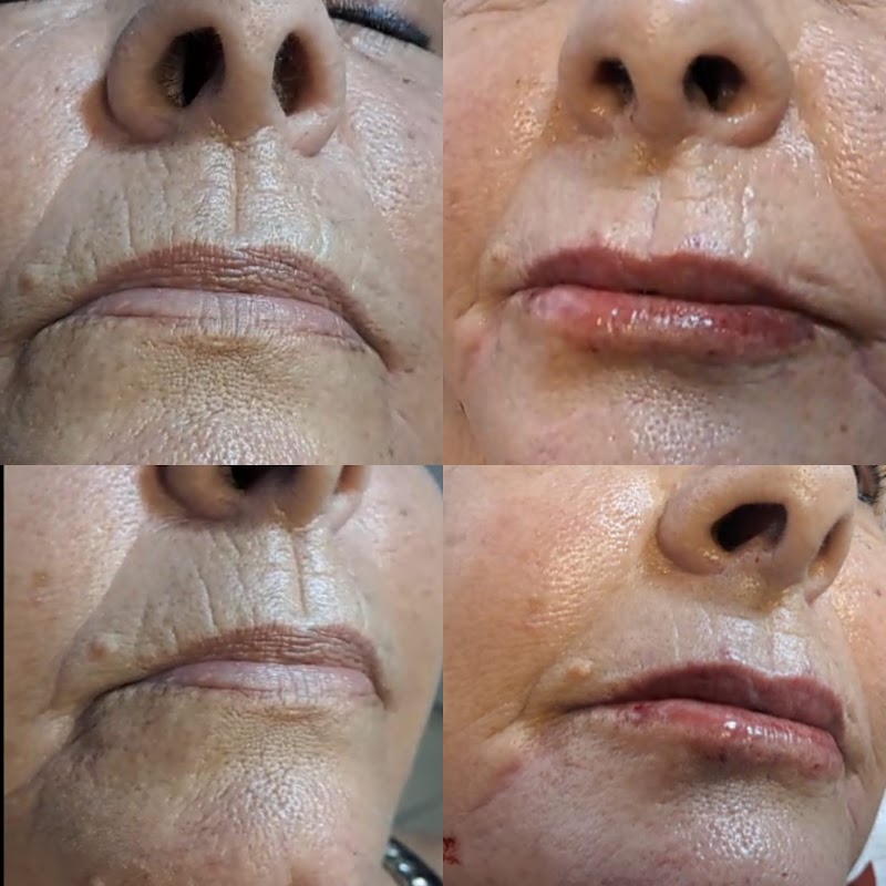 Dra Christine Sadler Estética em Jardim Camburi - Clínica de Estética em Jardim Camburi, Vitória/ES - Foto 5