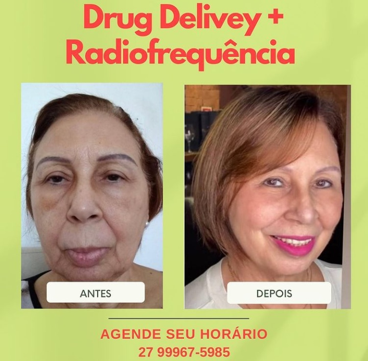 Modelly Estética Emagrecimento e terapias integradas - Clínica de Estética em Jardim Camburi, Vitória/ES - Foto 3