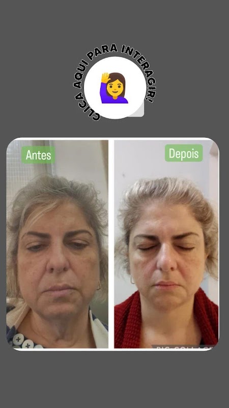 Modelly Estética Emagrecimento e terapias integradas - Clínica de Estética em Jardim Camburi, Vitória/ES - Foto 4