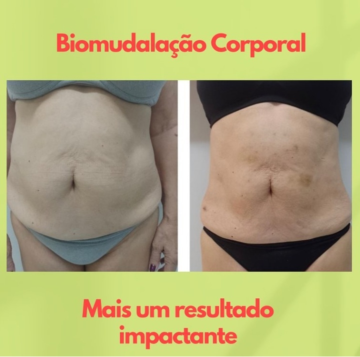 Modelly Estética Emagrecimento e terapias integradas - Clínica de Estética em Jardim Camburi, Vitória/ES - Foto 5