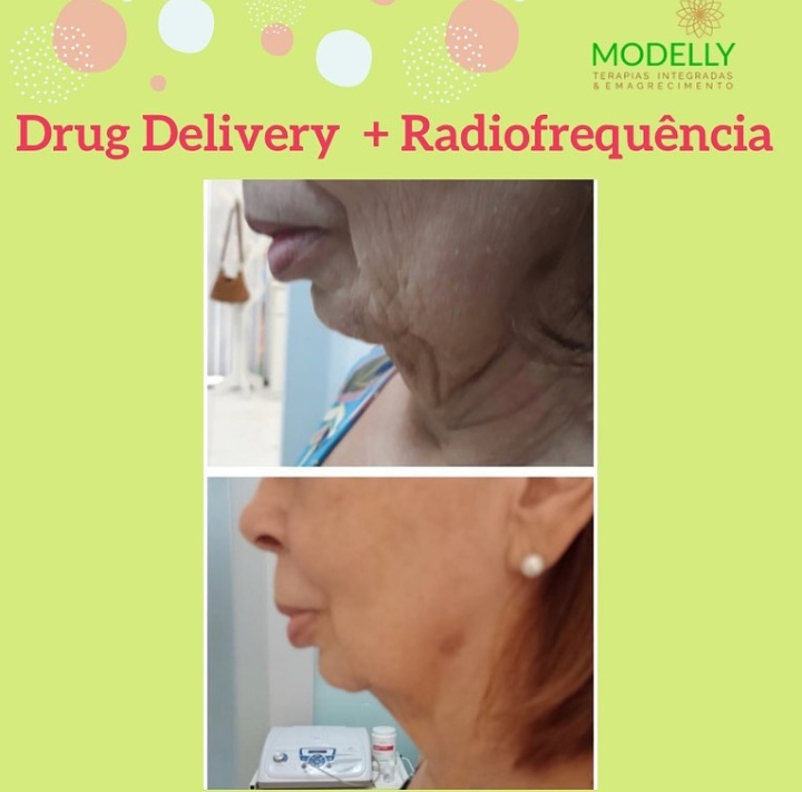 Foto 6 de Modelly Estética Emagrecimento e terapias integradas