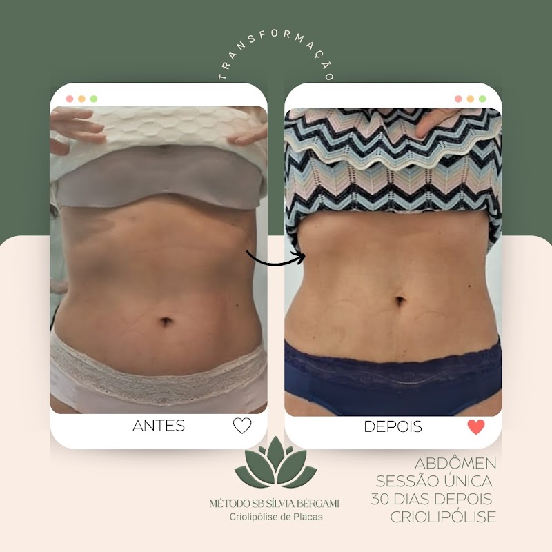 Silvia Bergami Esteticista e Criolipólise