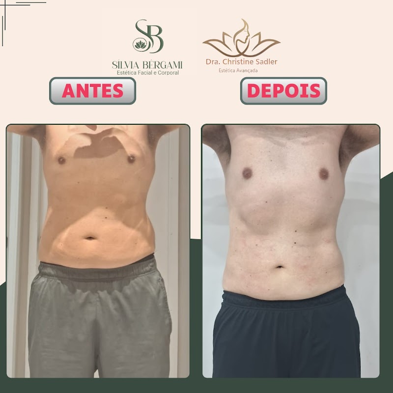 Silvia Bergami Esteticista E Criolipólise - Clínica de Estética em Jardim Camburi, Vitória/ES - Foto 2