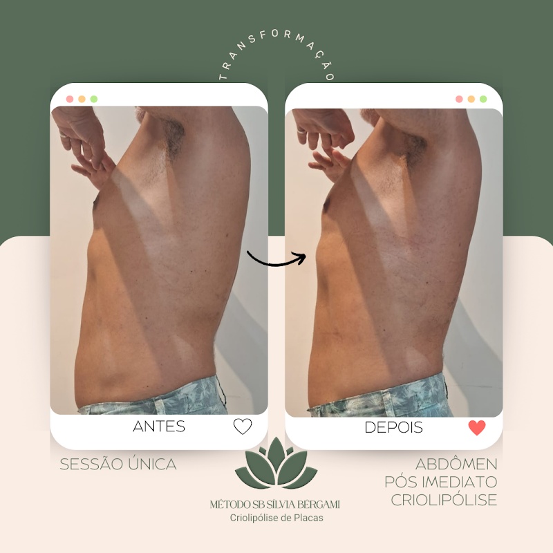 Silvia Bergami Esteticista E Criolipólise - Clínica de Estética em Jardim Camburi, Vitória/ES - Foto 3