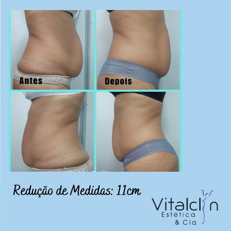 Vitalclyn Estética e Cia - Clínica de Estética em Jardim Camburi, Vitória/ES - Foto 5