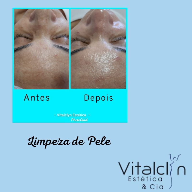 Foto 6 de Vitalclyn Estética e Cia