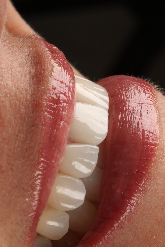 Foto 6 de Sorriso Vitória Odontologia