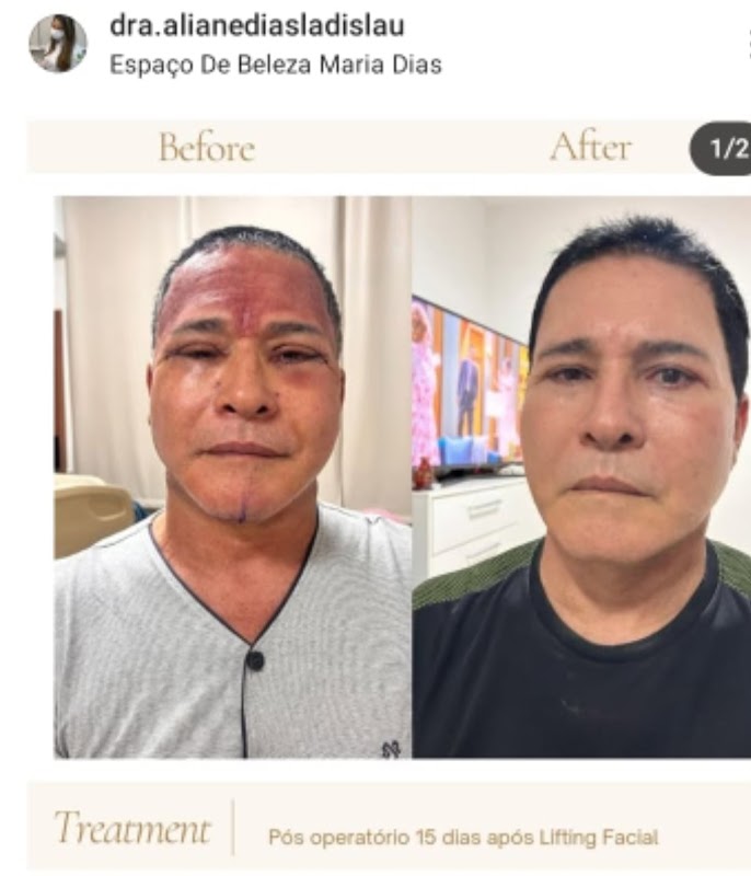 Dra Aliane Dias Fisioterapia Dermatofuncional - Fisioterapia em Jardim Camburi, Vitória/ES - Foto 4