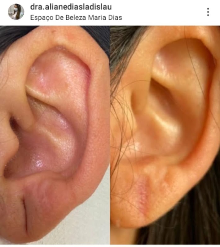 Dra Aliane Dias Fisioterapia Dermatofuncional - Fisioterapia em Jardim Camburi, Vitória/ES - Foto 5