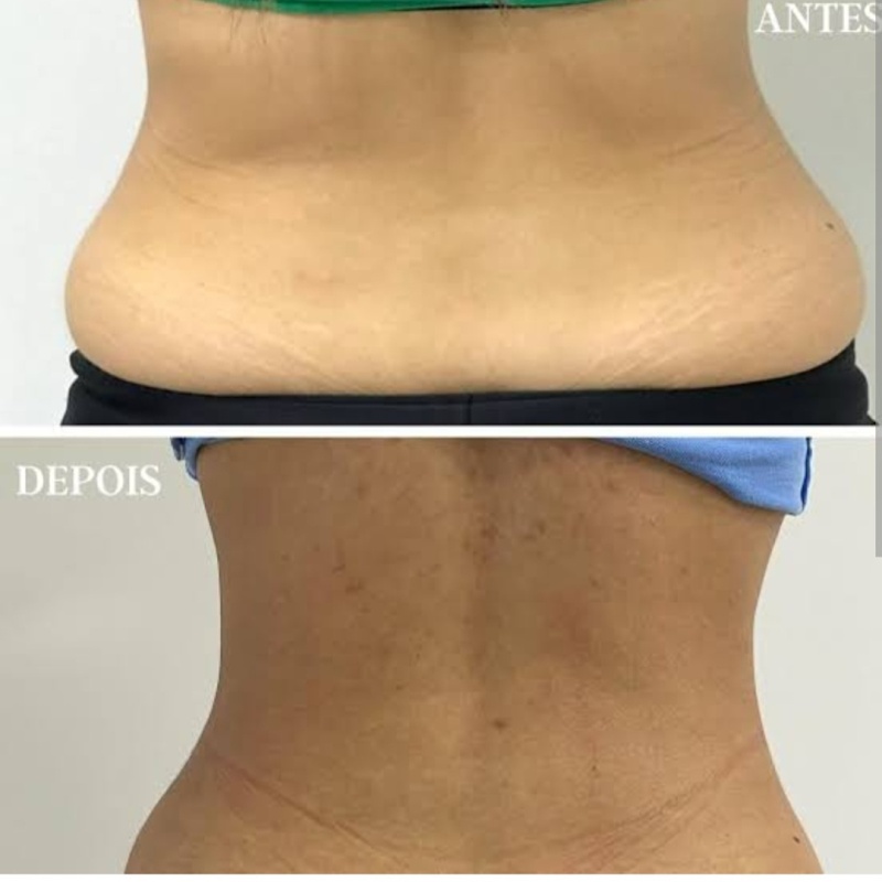 Foto 6 de Dra Aliane Dias Fisioterapia Dermatofuncional