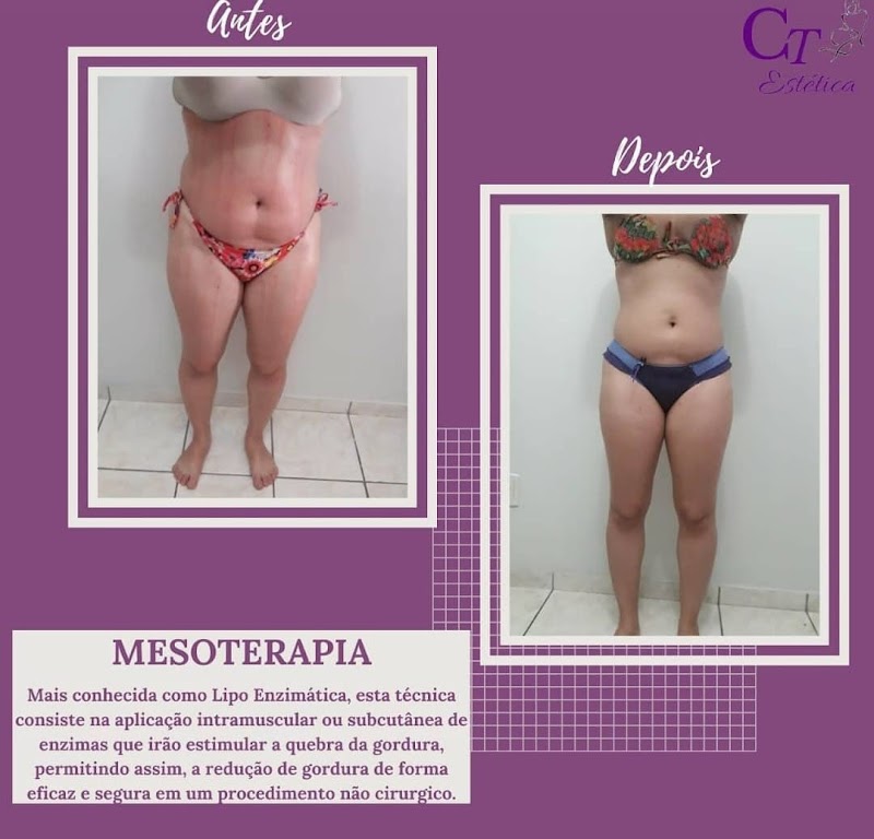 Estetica Cida Tartaglia | Esteticista Corporal em Jardim Camburi - Salão de Beleza em Jardim Camburi, Vitória/ES - Foto 5