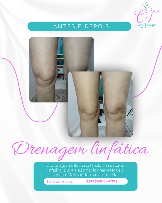 Foto 6 de Estética Cida Tartaglia